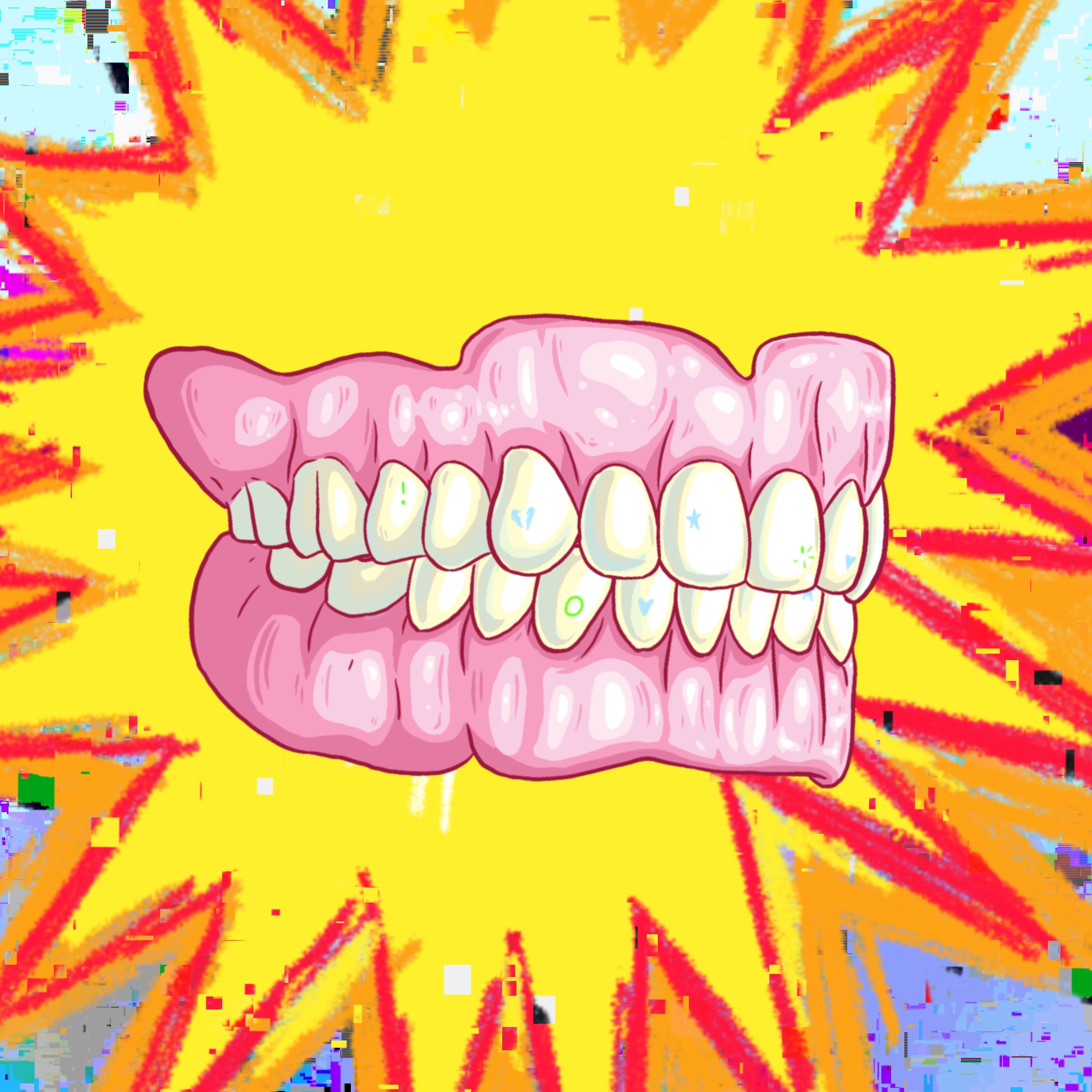 Clenched Teeth